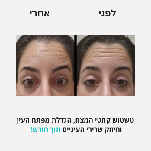 לירון - לפני אחרי פורמט חדש - 10