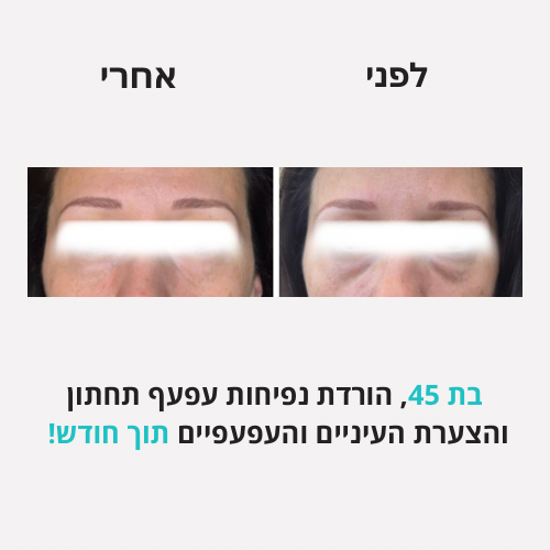 לירון - לפני אחרי פורמט חדש - 11
