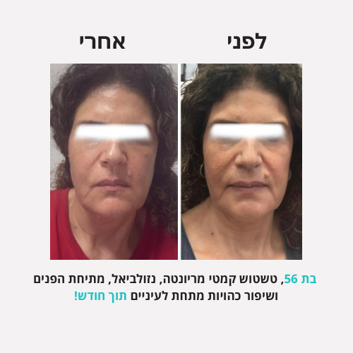 לירון - לפני אחרי פורמט חדש - 12