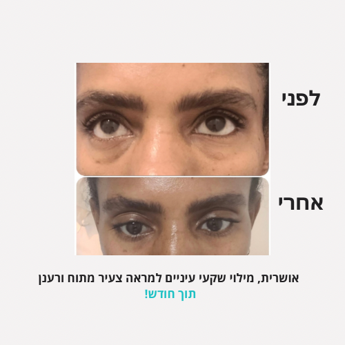 לירון - לפני אחרי פורמט חדש - 17