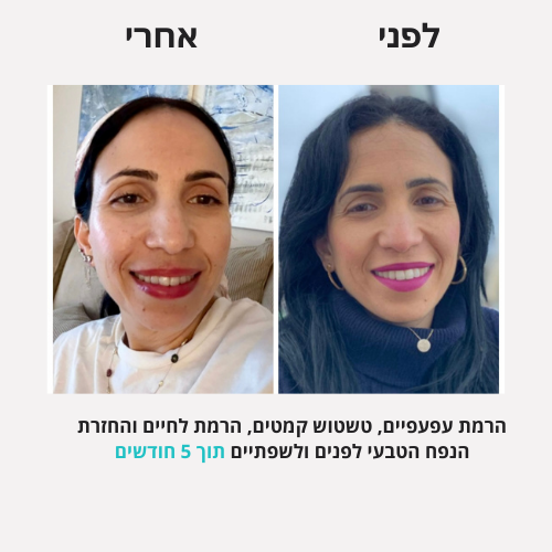 לירון - לפני אחרי פורמט חדש (2)