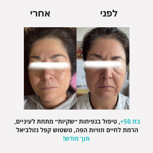 לירון - לפני אחרי פורמט חדש - 3 (1)
