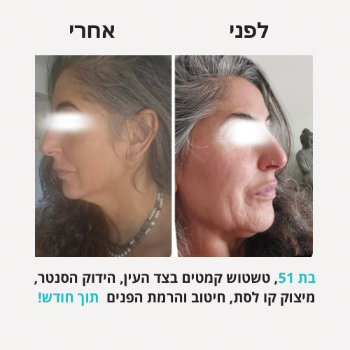 לירון - לפני אחרי פורמט חדש - 4