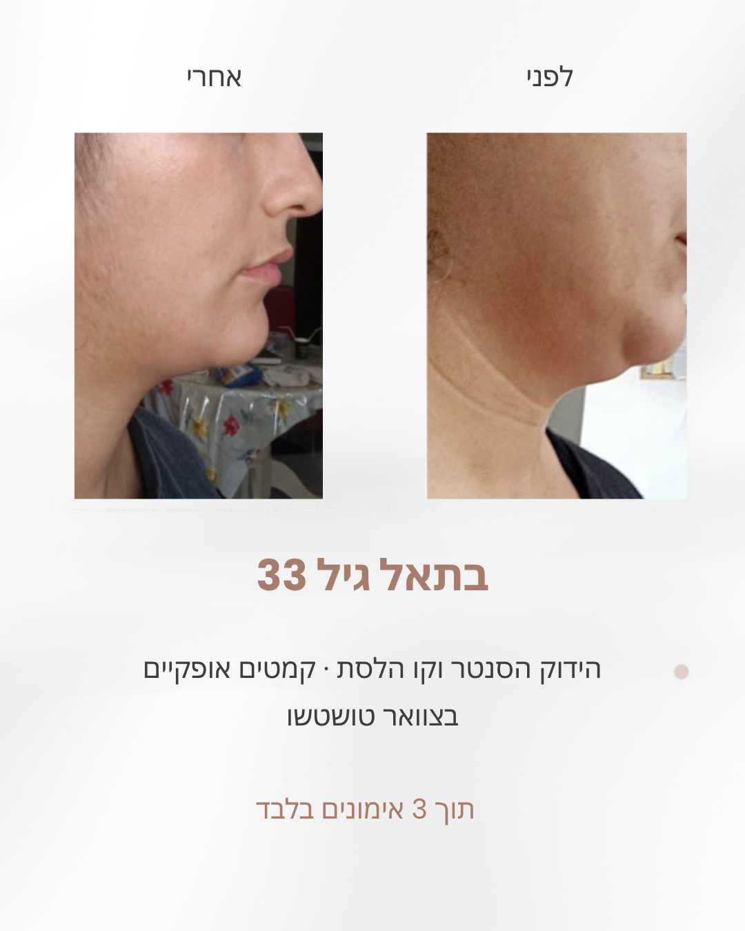 בתאל בת 33, לפני ואחרי שלושה אימונים: הידוק הסנטר וקו הלסת וטשטוש קמטים אופקיים בצוואר