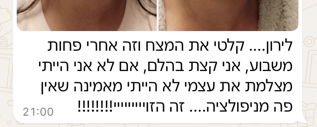 עדות ווטסאפ עם תמונת לפני ואחרי של המצח, אחרי פחות משבוע של תרגילי פנים