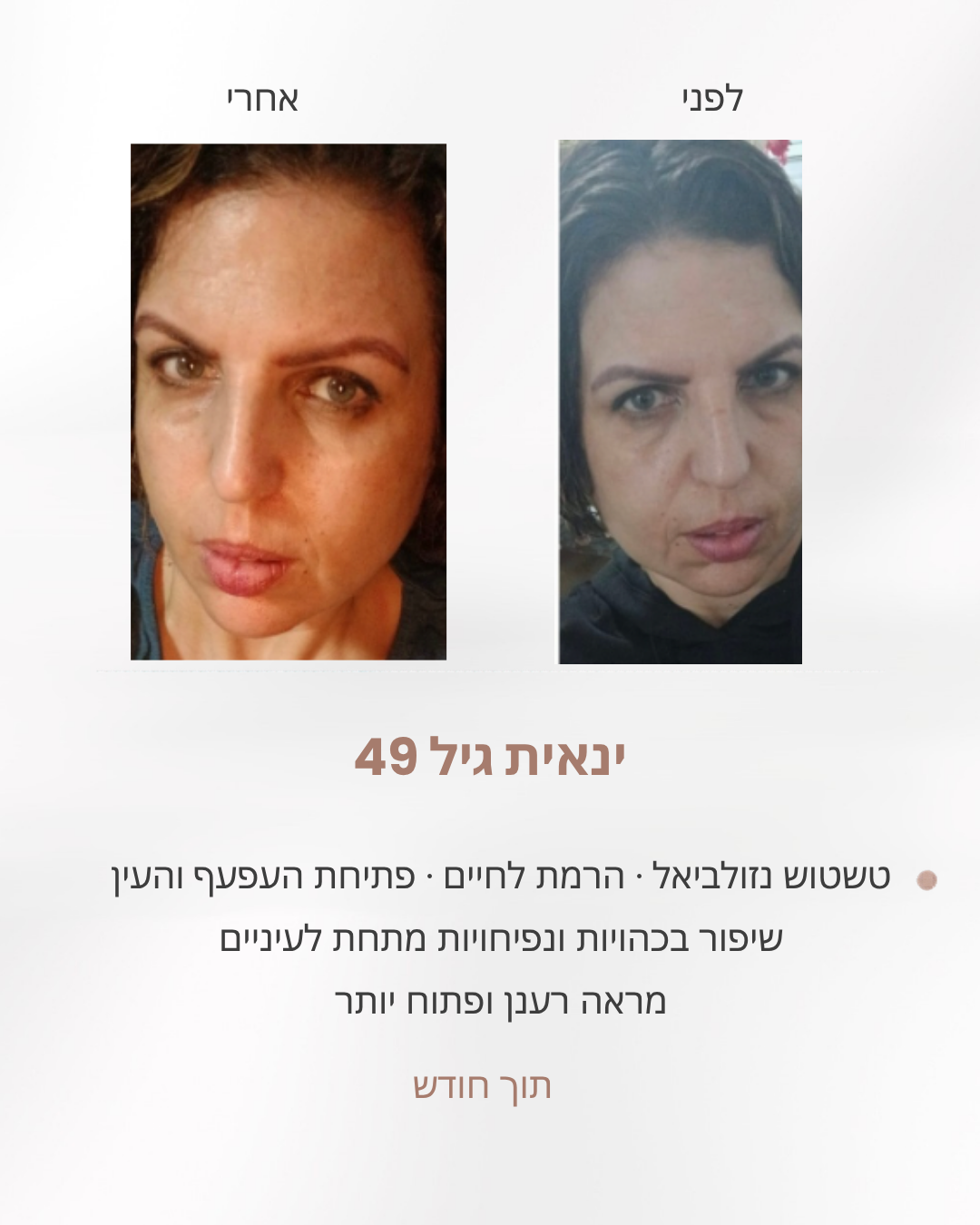 ינאית בת 49, לפני ואחרי חודש של תרגילי פנים: לחיים מורמות, עפעף ועין פתוחים יותר ופחות נפיחות מתחת לעיניים
