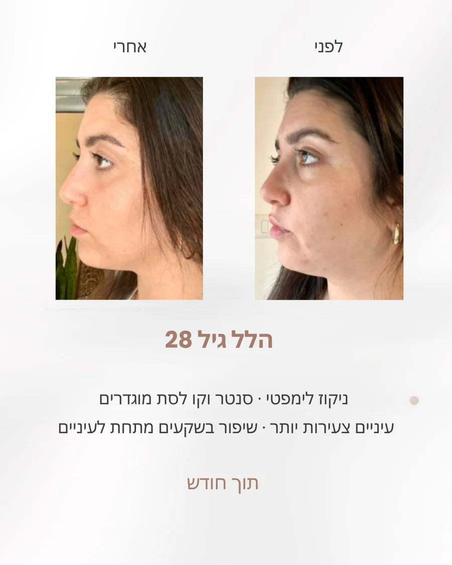 לפני ואחרי - neck